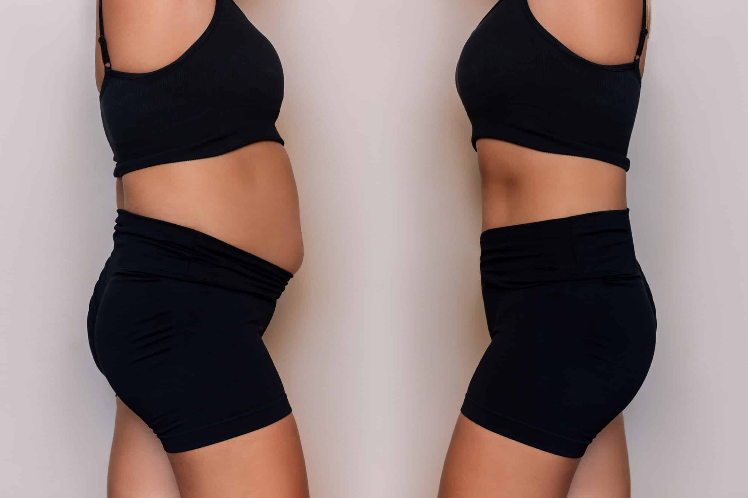 Woman in a black sportswear with a fat belly and toned slim abdomen before and after losing weight