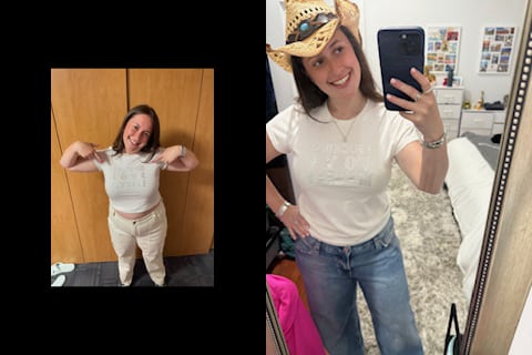 Billee before and after using tirzepatide for 3 months